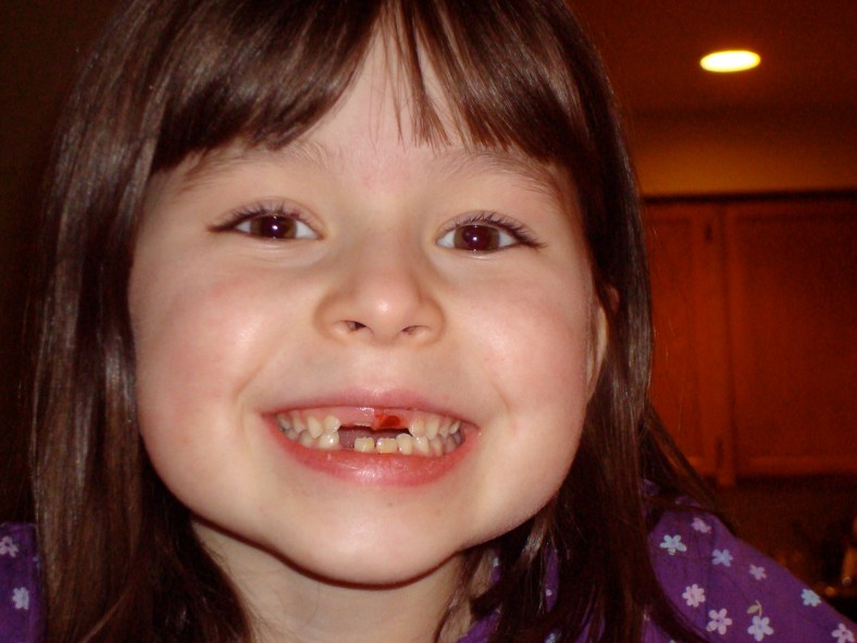 This is getting expensive!